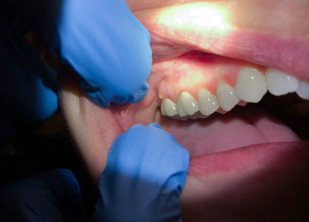 Best Cosmetic Emergency Dentistry in Diablo Grande, CA